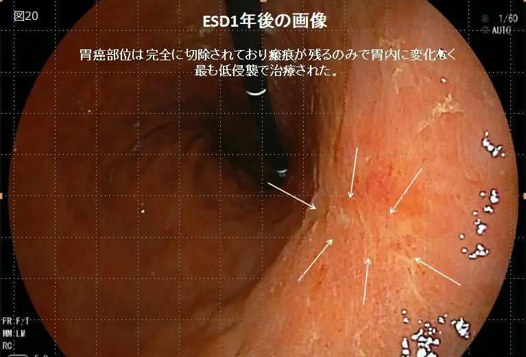 07eabe63d1b9896986e32c0727b075